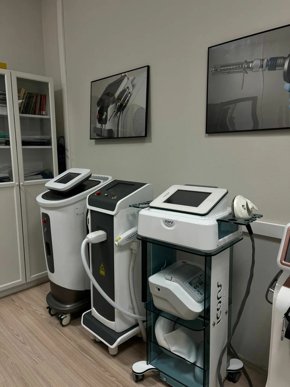 Консультация и подбор параметров