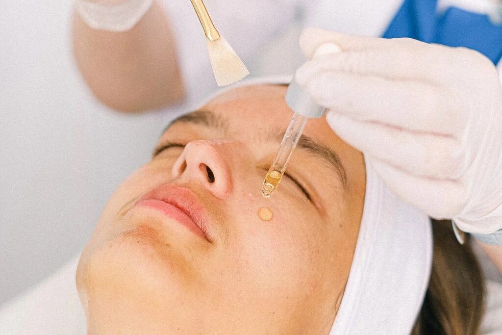 Пилинг лица в Nude Laser, Королёв
